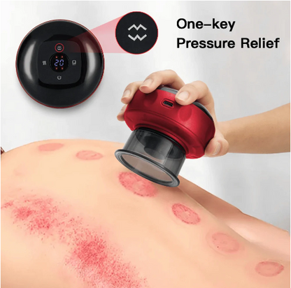 Electric Vacuum Cupping Massager